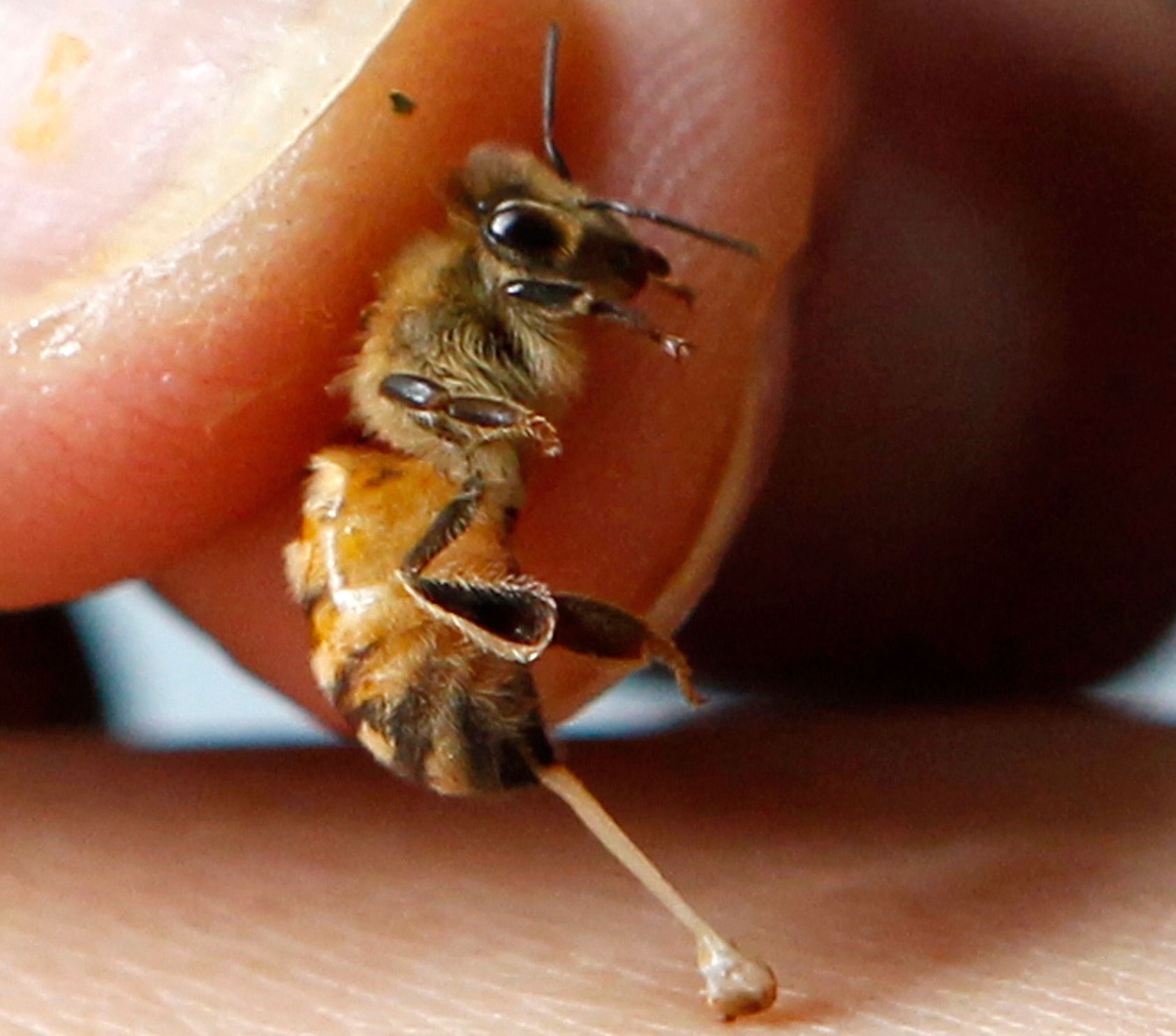 Bienengift-Heiler aus Telde von Ärztekammer angezeigt
